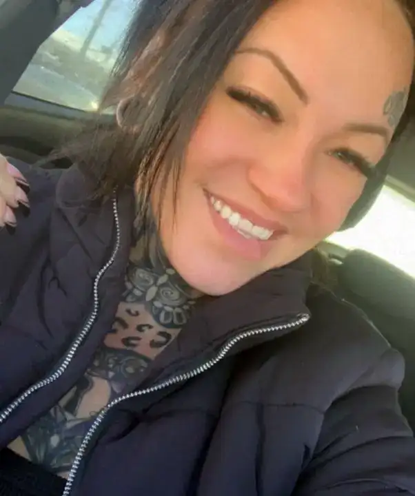 Antalya’daki Estetik Operasyonu Felaketle Bitti 1